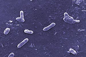 Bordetella bronchiseptica bacterie